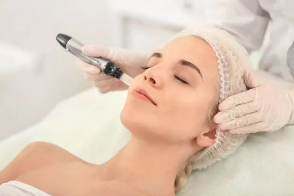 Điều trị bằng laser